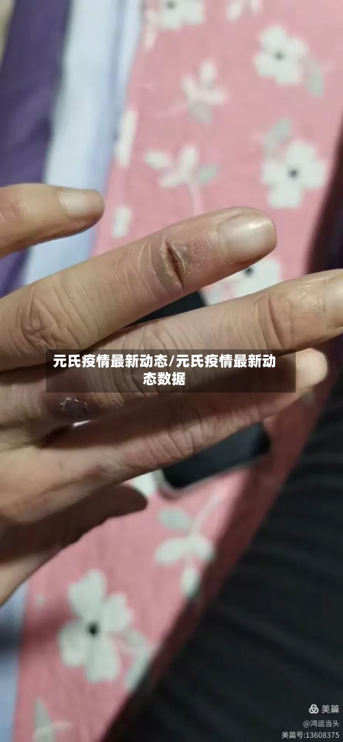 元氏疫情最新动态/元氏疫情最新动态数据
