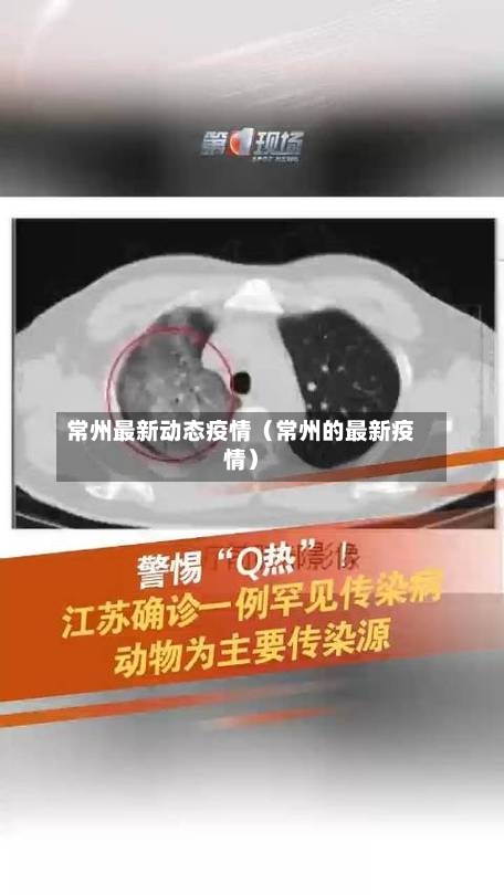 常州最新动态疫情（常州的最新疫情）-第1张图片